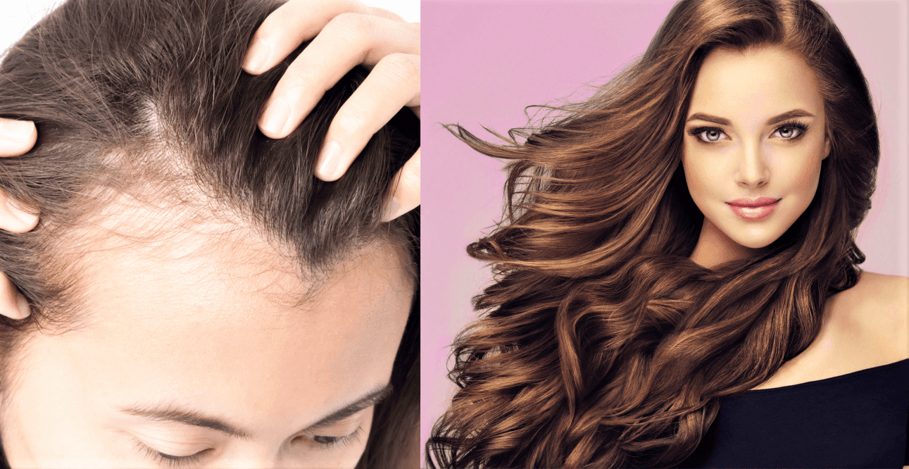 how-to-hide-bald-spots-make-hair-look-voluminous-beauty-tips-by-nim