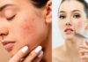 Tips to Control Excess Redness on the Face With Pictures - Beauty Tips By Nim - Nimisha Goyal - HashBUGS - BTN - Nimify Beauty - beautytipsbynim.com